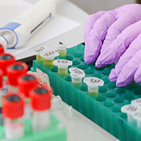 Lab worker with surgical gloves working with samples